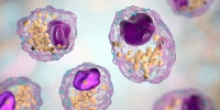Lipids: measurement and management